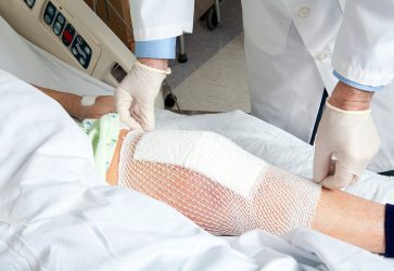 tratamiento artrosis de rodilla